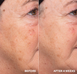 Liquid Resurfacing Solution &ndash; Щоденний незмивний лосьйон-ексфоліант з 2% саліцилової кислоти 1004 фото 2