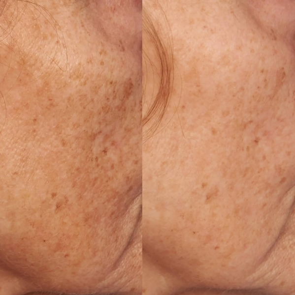 Висвітлюваний засіб з вітаміном С - VITAMIN C ESTER INTENSIVE DARK SPOT TREATMENT p0044 фото